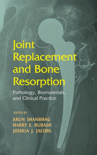 Book cover of: Joint Replacement and Bone Resorption