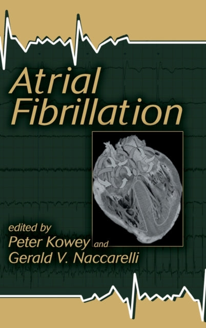Book cover of: Atrial Fibrillation