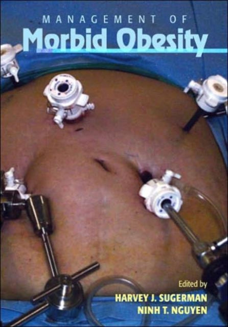 Book cover of: Management of Morbid Obesity