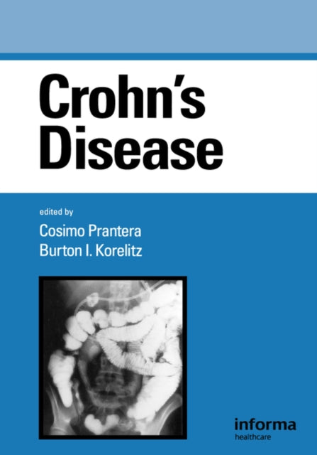 Book cover of: Crohn's Disease