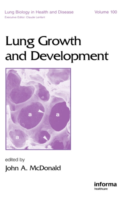 Book cover of: Lung Growth and Development