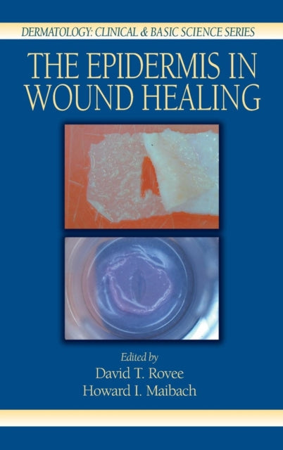 Book cover of: Epidermis in Wound Healing