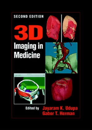 3D Imaging in Medicine, Second Edition