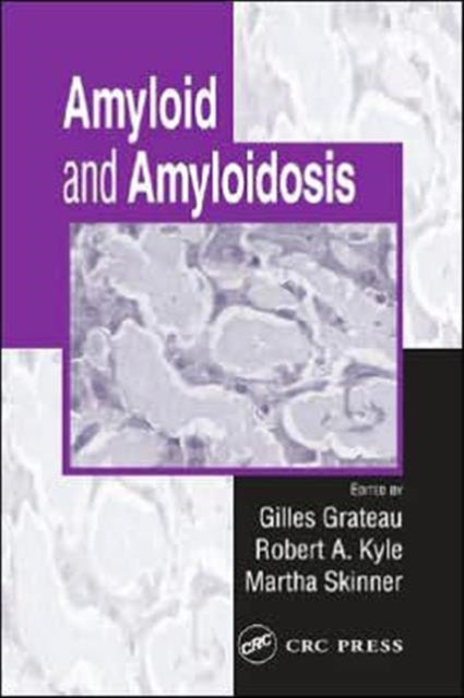 Book cover of: Amyloid and Amyloidosis