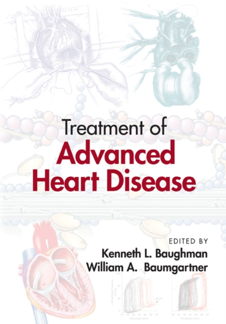 Book cover of: Treatment of Advanced Heart Disease