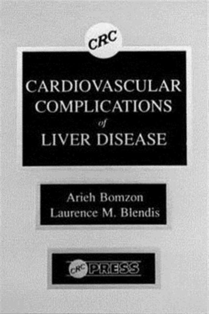 Book cover of: Cardiovascular Complications of Liver Disease