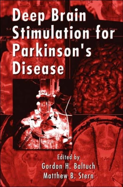 Book cover of: Deep Brain Stimulation for Parkinson's Disease