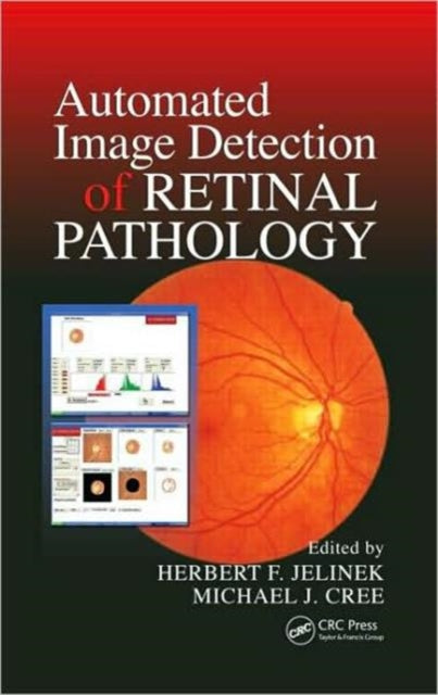 Book cover of: Automated Image Detection of Retinal Pathology. By: Herbert Jelinek