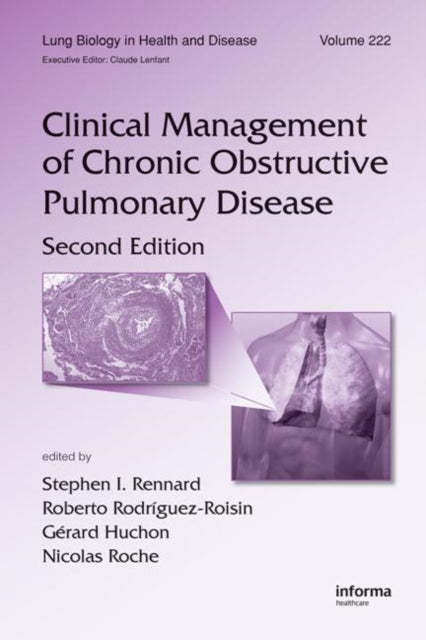 Book cover of: Clinical Management of Chronic Obstructive Pulmonary Disease