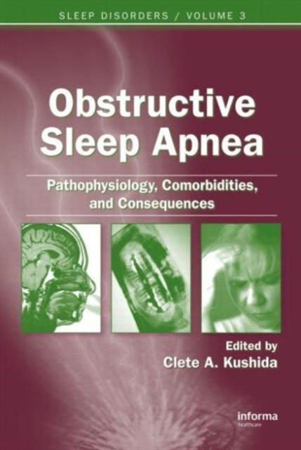 Book cover of: Obstructive Sleep Apnea: Pathophysiology, Comorbidities and Consequences. By: Clete A. Kushida