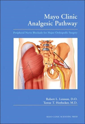 Mayo Clinic Analgesic Pathway