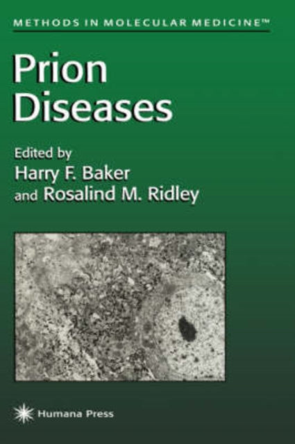 Book cover of: Prion Diseases