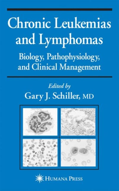Book cover of: Chronic Leukemias and Lymphomas. By: Gary J. Schiller