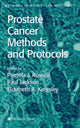 Book cover of: Prostate Cancer Methods and Protocols