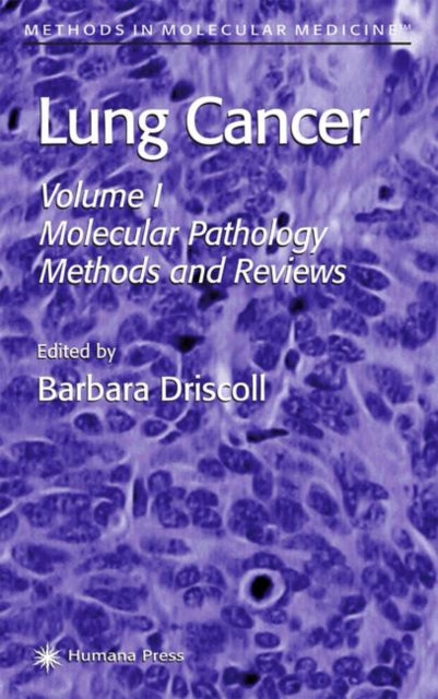 Book cover of: Lung Cancer. By: Barbara Driscoll