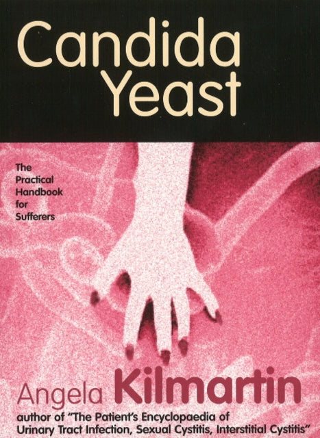 Book cover of: Candida. By: Angela Kilmartin