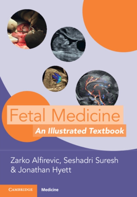 Book cover of: Fetal Medicine. By: Zarko Alfirevic