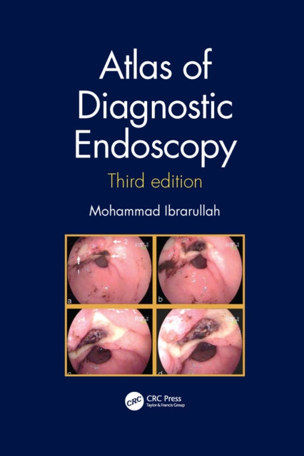 Book cover of: Atlas of Diagnostic Endoscopy, 3E. By: Mohammad Ibrarullah