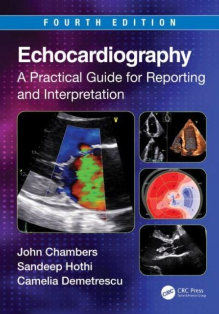 Book cover of: Echocardiography. By: John Chambers