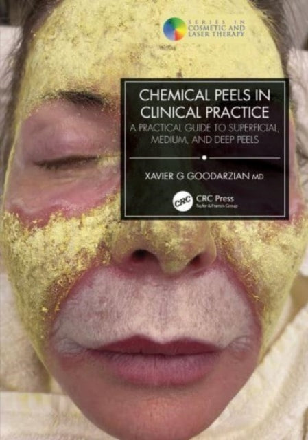 Book cover of: Chemical Peels in Clinical Practice. By: Xavier G. Goodarzian