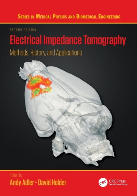 Book cover of: Electrical Impedance Tomography. By: David Holder
