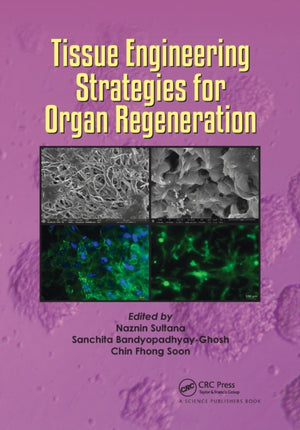 Tissue Engineering Strategies for Organ Regeneration