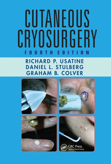 Book cover of: Cutaneous Cryosurgery. By: Richard Usatine