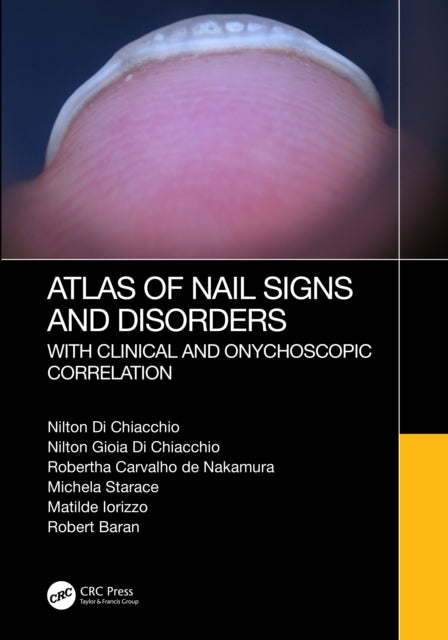 Book cover of: Atlas of Nail Signs and Disorders with Clinical and Onychoscopic Correlation. By: Nilton di Chiacchio