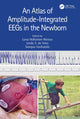 Book cover of: Atlas of Amplitude-Integrated EEGs in the Newborn