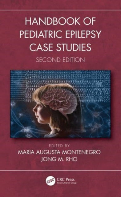 Book cover of: Handbook of Pediatric Epilepsy Case Studies, Second Edition. By: Jong M. Rho