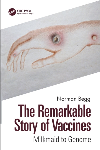 Book cover of: Remarkable Story of Vaccines. By: Norman T. Begg