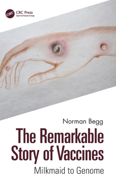 Book cover of: Remarkable Story of Vaccines. By: Norman T. Begg