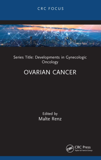 Book cover of: Ovarian Cancer