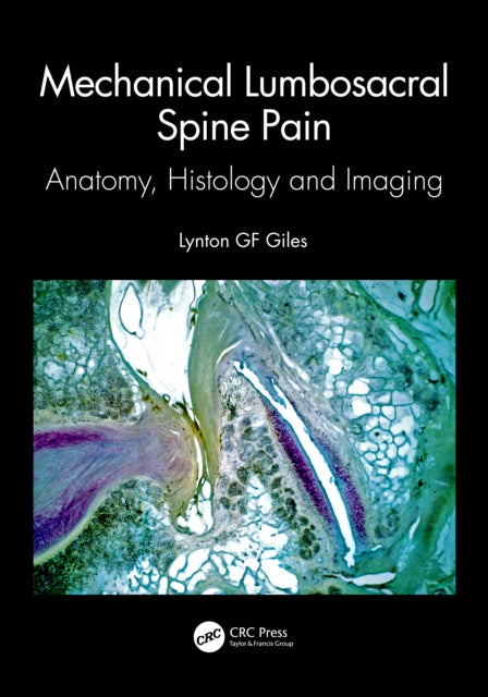 Book cover of: Mechanical Lumbosacral Spine Pain. By: Lynton G. F Giles