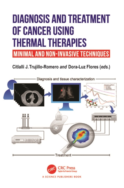Book cover of: Diagnosis and Treatment of Cancer using Thermal Therapies. By: Citlalli J. Trujillo-Romero