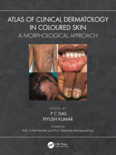 Book cover of: Atlas of Clinical Dermatology in Coloured Skin. By: P. C. Das