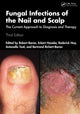 Book cover of: Fungal Infections of the Nail and Scalp. By: Robert Baran