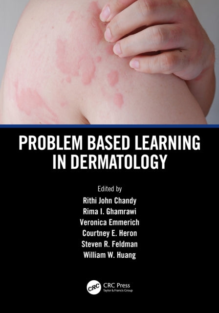 Book cover of: Problem Based Learning in Dermatology. By: Rithi John Chandy