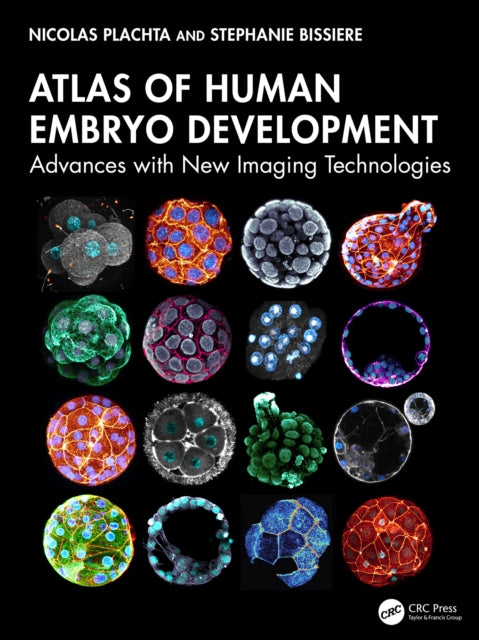 Book cover of: Atlas of Human Embryo Development