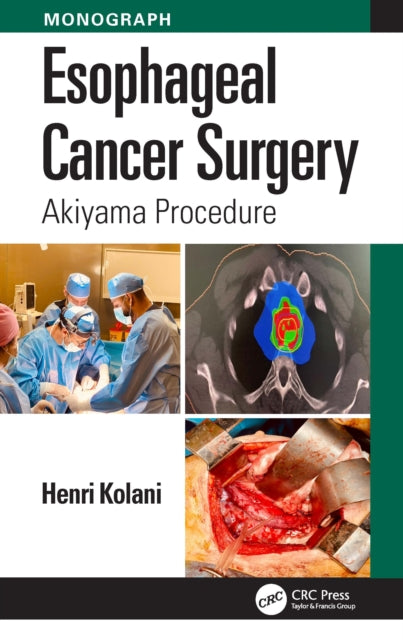 Book cover of: Esophageal Cancer Surgery. By: Henri Kolani