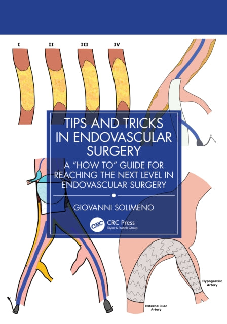 Book cover of: Tips and Tricks in Endovascular Surgery