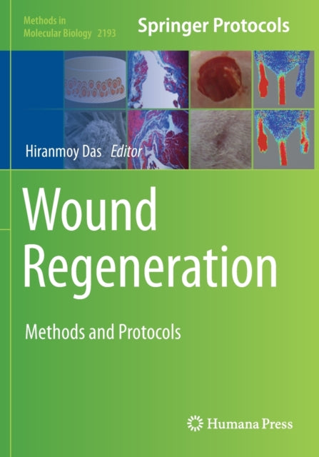Book cover of: Wound Regeneration. By: Hiranmoy Das