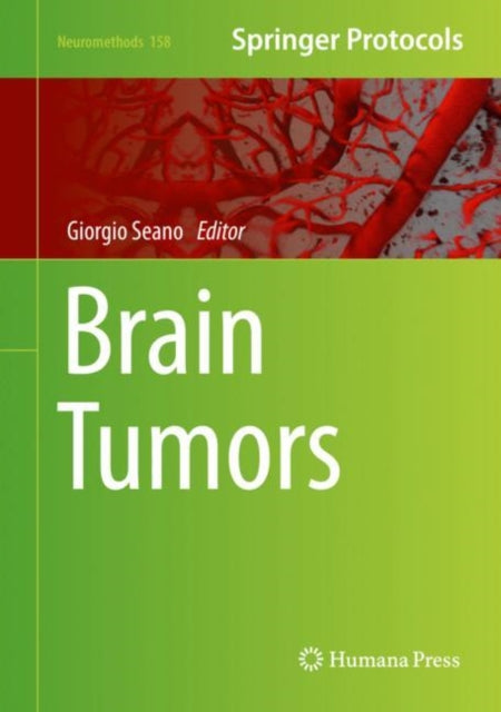 Book cover of: Brain Tumors. By: Giorgio Seano