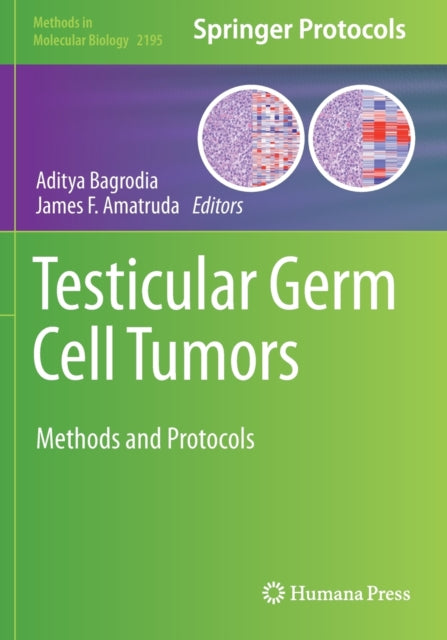 Book cover of: Testicular Germ Cell Tumors. By: Aditya Bagrodia