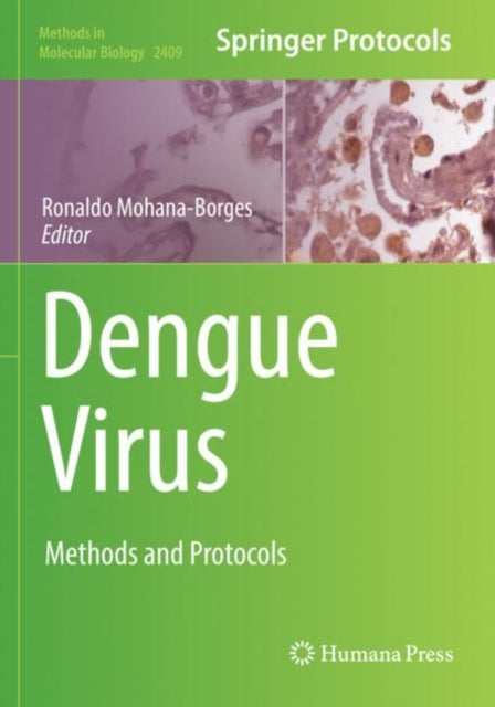 Book cover of: Dengue Virus. By: Ronaldo Mohana-Borges