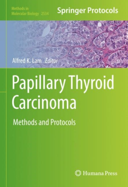 Book cover of: Papillary Thyroid Carcinoma. By: Alfred K. Lam