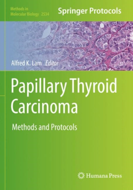 Book cover of: Papillary Thyroid Carcinoma. By: Alfred K. Lam