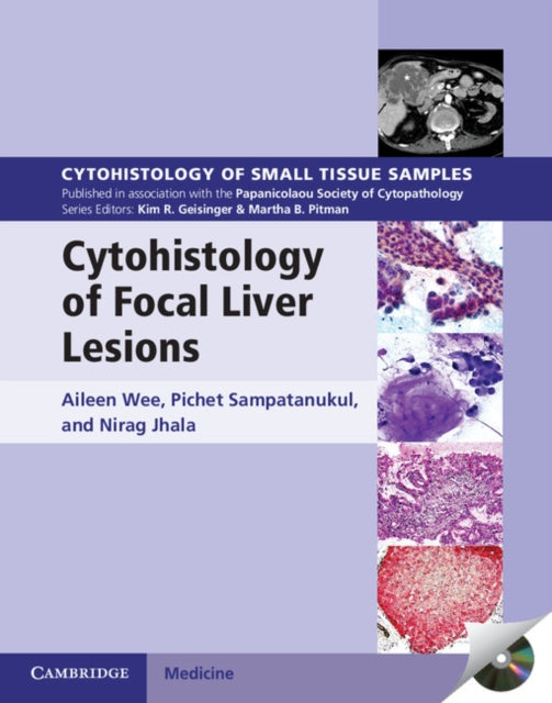 Book cover of: Cytohistology of Focal Liver Lesions. By: Aileen Wee