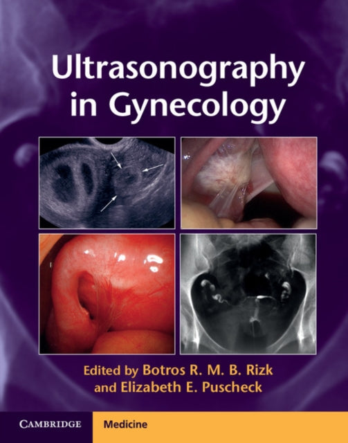Book cover of: Ultrasonography in Gynecology. By: Botros R. M. B. Rizk