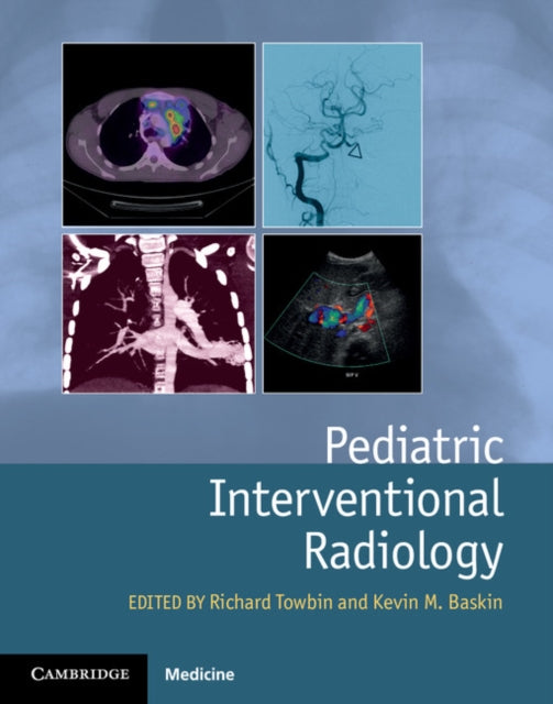 Book cover of: Pediatric Interventional Radiology. By: Richard Towbin